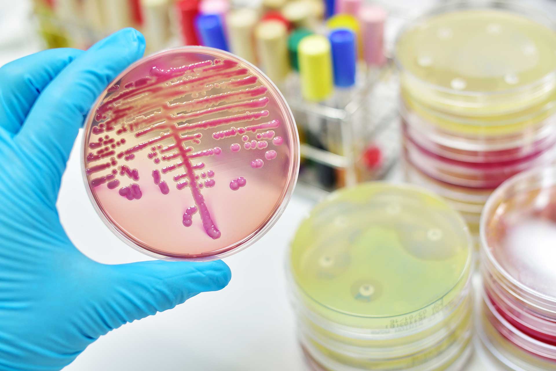 urologicum duisburg diagnostic-mikrobiologie