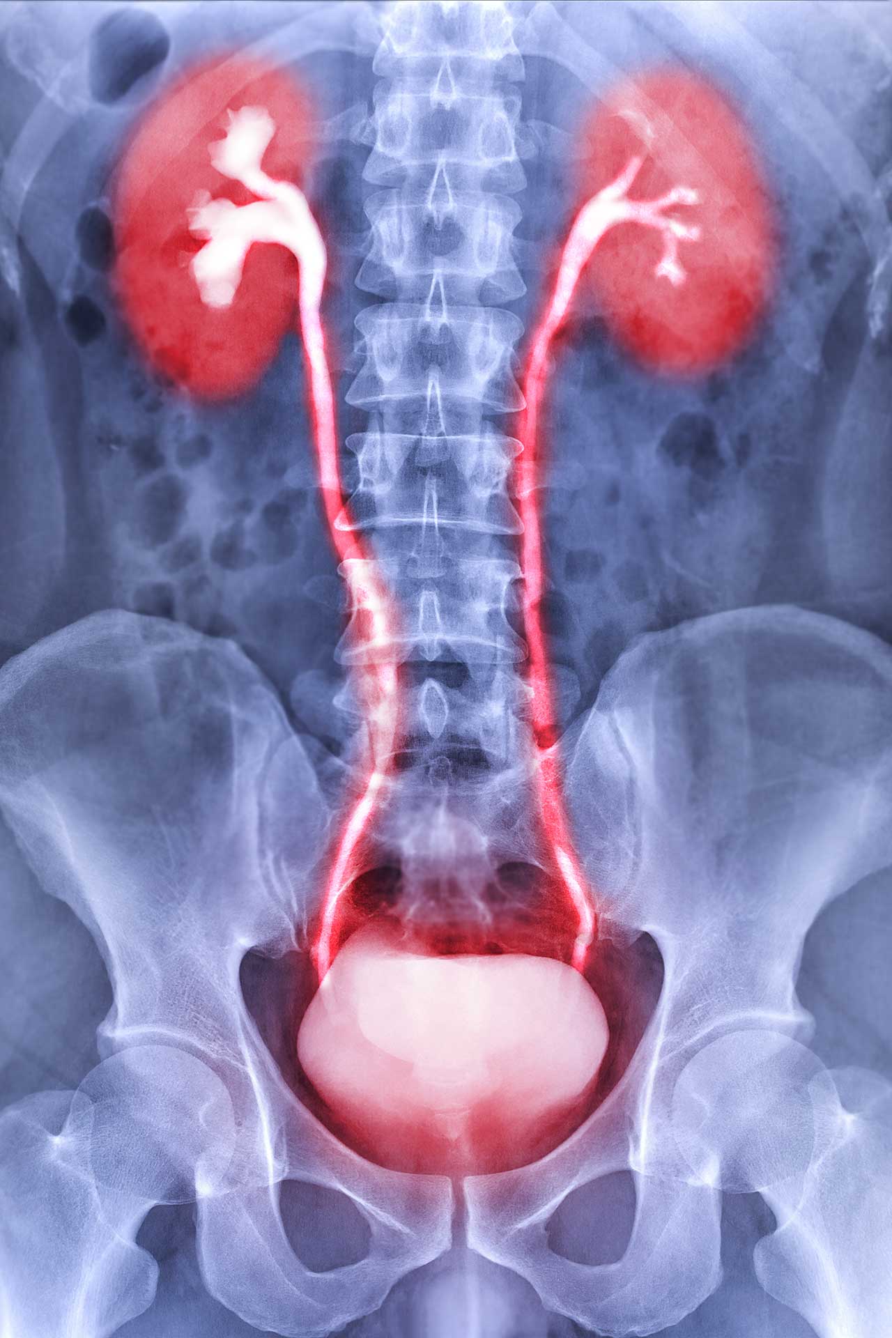 urologicum duisburg diagnostic-roentgen